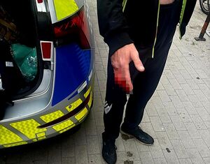 radiowóz a obok mężczyzna z rozciętą ręką
